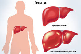 kak-uberechsya-ot-zabolevanyj-chto-peredayutsya-polovym-putem